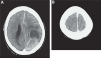 Figure 1a-b: Axial CCT
