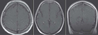 Figure 1: MRI
