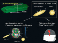 Abbildung 2: Anisotrope Diffusion