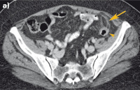 Abbildung 1a: MDCT