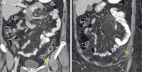 Abbildung 1b-c: MDCT