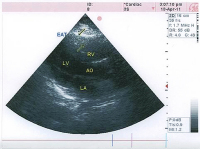 Figure 1: EAT