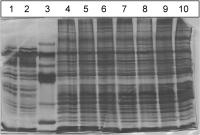 Figure 1: Aquaporinexpression - Proteinexpression