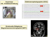 Abbildung 4: Epilepsie - Diagnostik