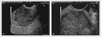 Abbildung 1a-b: Tumor - Magen