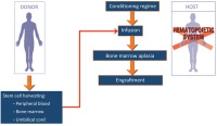 Figure 2: Transplant Procedure