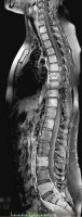 Figure 1: Spine