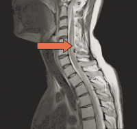Figure 1-1: Spine