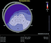 Abbildung 14: Bull's Eye