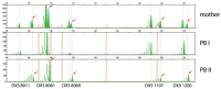Abbildung 1: Polar body diagnosis for haemophilia A