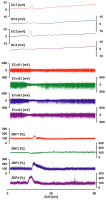 Abbildung 1: Spreading Depolarization