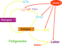 Abbildung 1: PCOS