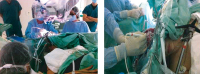 Figure 1: Awake Craniotomy
