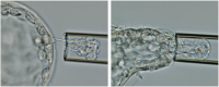 Abbildung 2: Trophoblastbiopsie