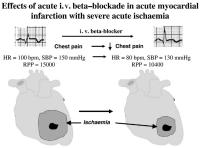 Figure 4: Myokardinfarkt - Betablockade