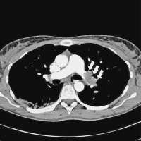Abbildung 1: CT-Angiographie