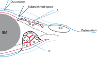 Figure 1: Meningeal infiltration