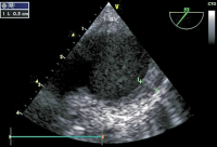 Abbildung 3: Aorta thoracica
