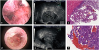 Abbildung 2a-f: Uterus