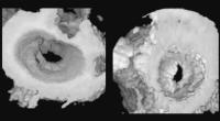 Figure 3: 3D-Echokardiographie