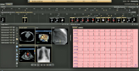 Abbildung 1: Produkt: IntelliSpace Cardiovascular<br>Vertrieb: Philips Austria GmbH 