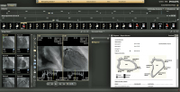 Abbildung 2: Produkt: IntelliSpace Cardiovascular<br>Vertrieb: Philips Austria GmbH