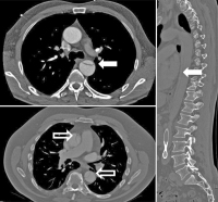 Abbildung 2: Aorta