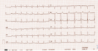 Abbildung 2: EKG