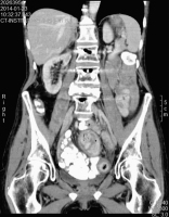Abbildung 1: CT-Abdomen