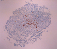 Abbildung 3: Immunhistologie