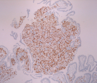Abbildung 5: Immunhistologie
