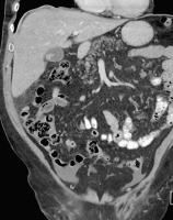 Abbildung 1: MDCT