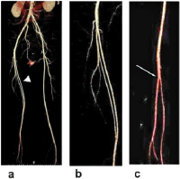 Abbildung 4a-c: Aortenbifurkation