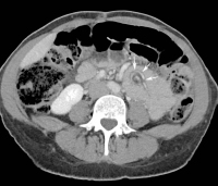 Abbildung 1a: MDCT
