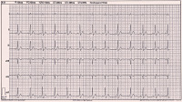 Abbildung 2: EKG