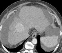 Abbildung 1a: MDCT