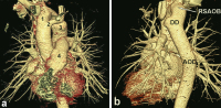Abbildung 1a-b: CT-Angiographie