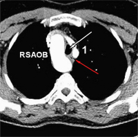 Abbildung 2: CT-Angiographie
