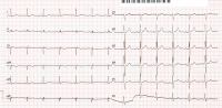 Abbildung 2: EKG