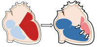 Abbildung 3: COPD