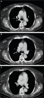 Abbildung 2a-c: Thorax-CT