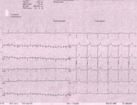 Abbildung 1: EKG