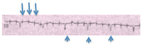 Abbildung 2: EKG