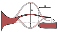 Abbildung 4: PFO