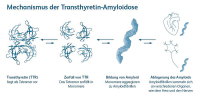 Abbildung 2: Transthyretin-Amyloidose