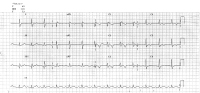 Abbildung 1: Ruhe-EKG
