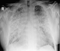 Abbildung 2: Radiologischer Befund