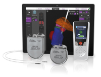 Produkt: DBS-Family<br>Vetrieb: Boston Scientific