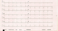 Abbildung 3: EKG