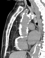 Abbildung 2: Aorta